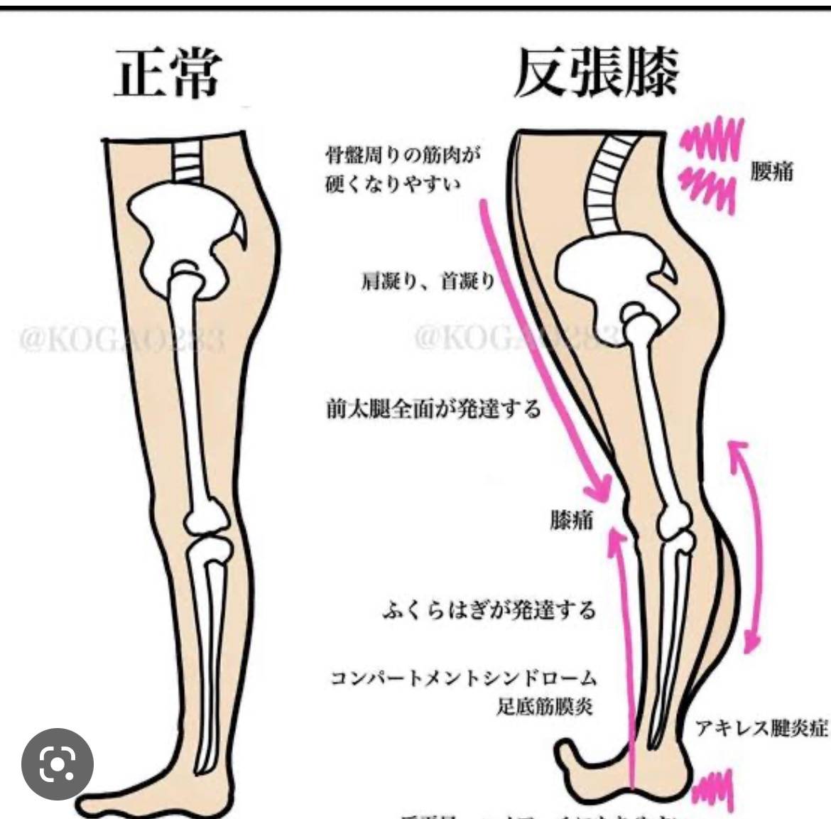 どこに行っても改善しない身体はこちら！おススメ目黒エステサロン